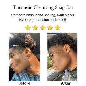 Turmeric Cleansing Bar